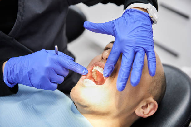 Best Dental Abscess Treatment in Castalia, OH